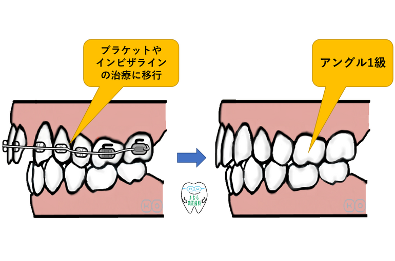 経過2